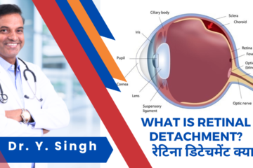 retinal detachment