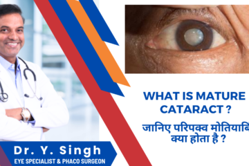 Mature Cataract