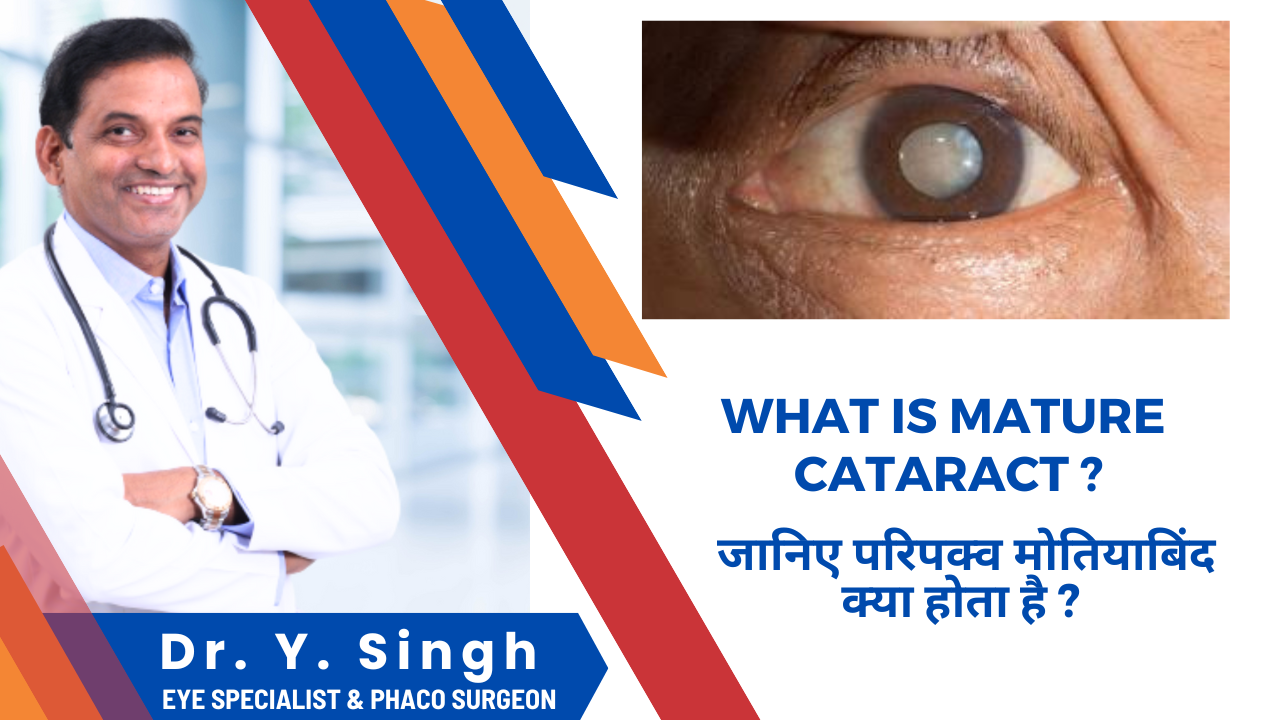 परिपक्व मोतियाबिंद (Mature Cataract)