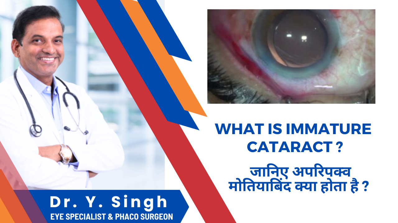 Immature Cataract