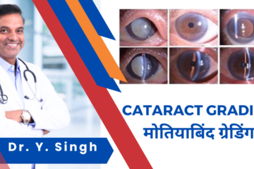Cataract Grading