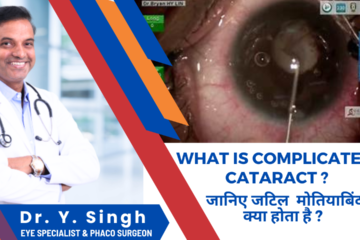 Complicated Cataract