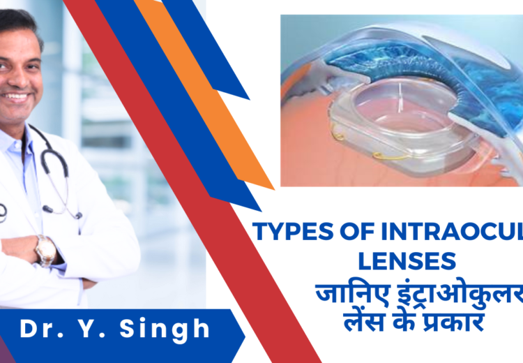 Types of Intraocular Lenses (IOLs)