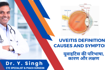 Uveitis