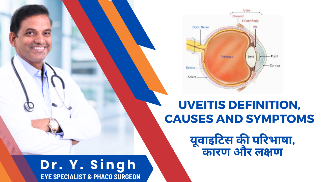 Uveitis