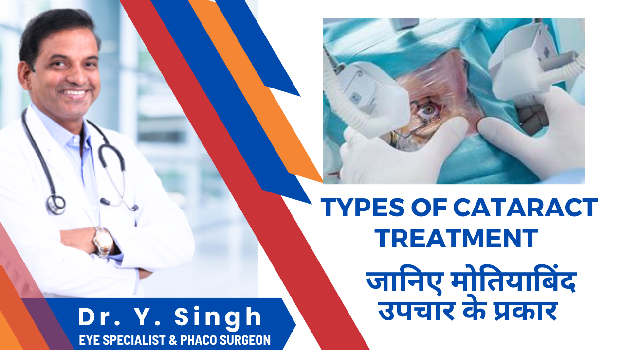 मोतियाबिंद उपचार के प्रकार (Types of Cataract Treatment)